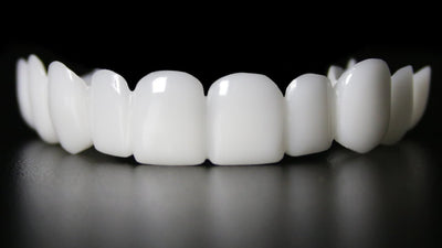 Snap on smile veneers