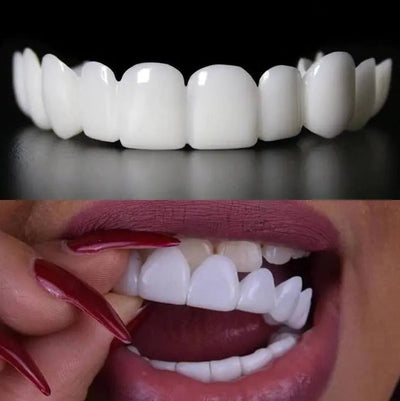 New Perfect Smile Pro - Snap On Smile Veneers Set